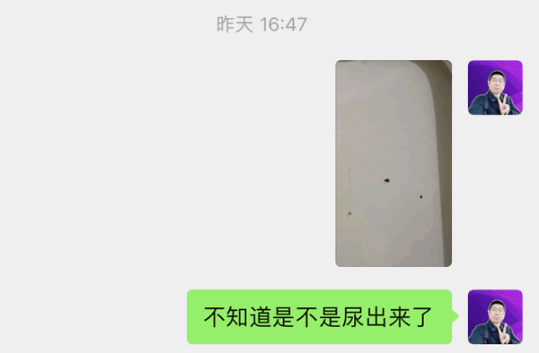 突然肾结石了：这时候我才意识到问题 生活感悟 微生活 第4张